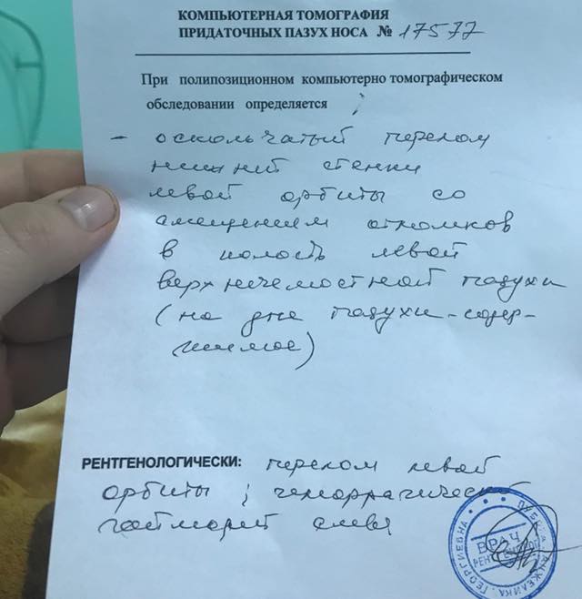 Запорожскому активисту, которому прострелили ногу, нужна сложная операция на глазу (ФОТО)