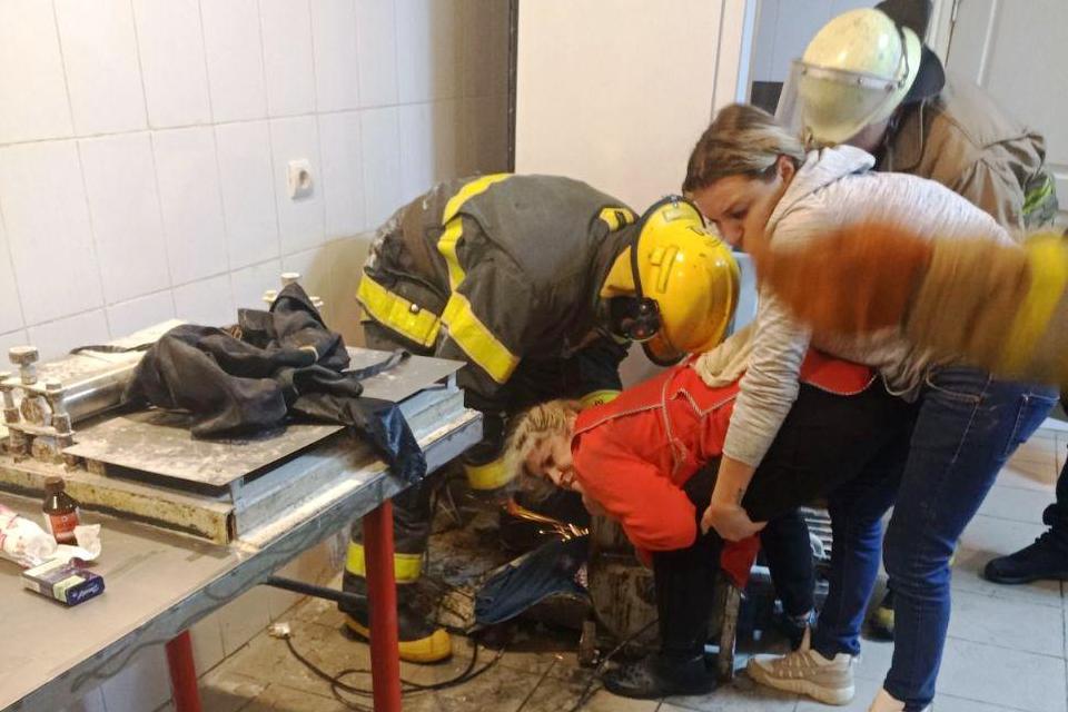 Жительница Запорожской области едва не лишилась руки, пока пекла хлеб (ФОТО)