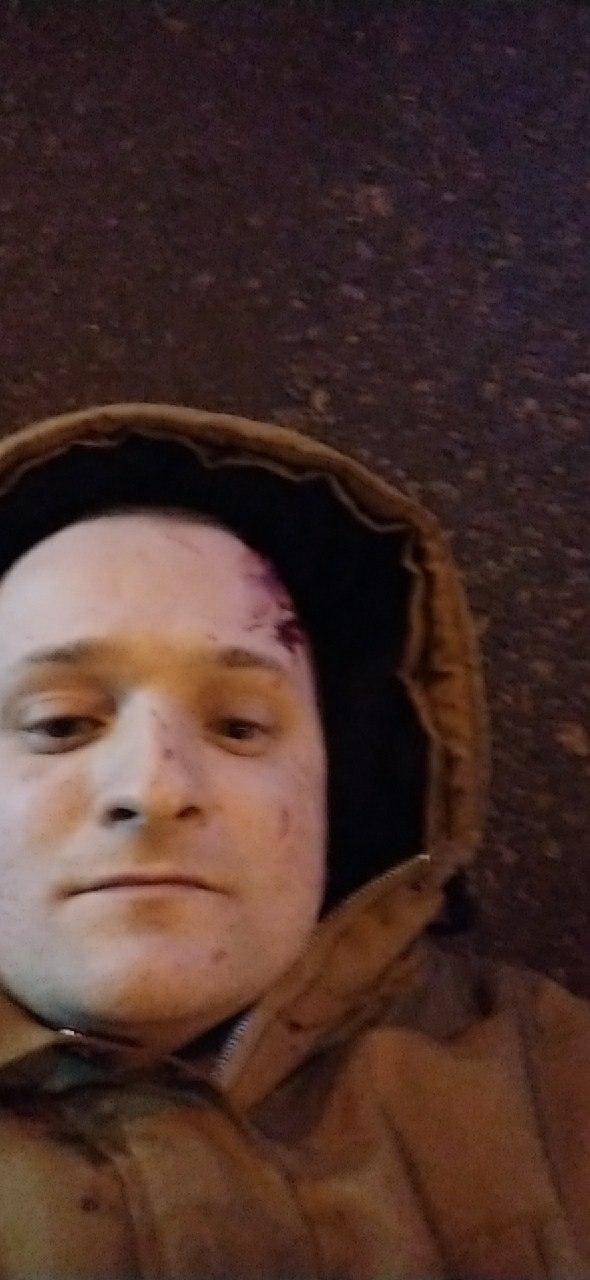 В Запорожье пострадавший в ДТП делал селфи, лёжа на проезжей части (ФОТО)