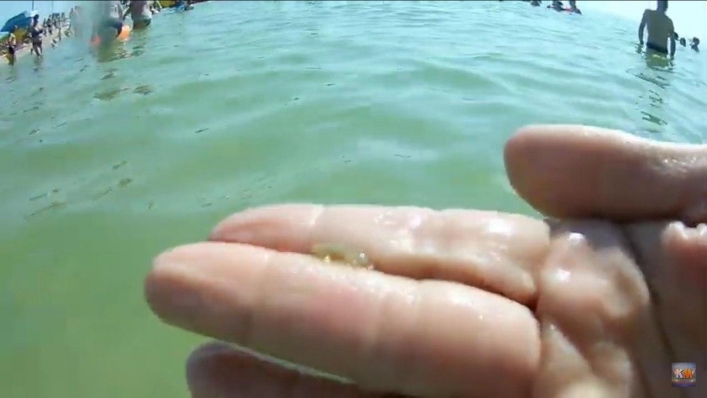 Нигде не спрятаться: Молочный лиман заполонили медузы (ФОТО)