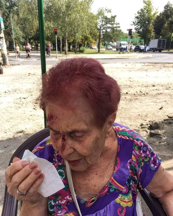 В Запорожье женщина из-за халатности рабочих разбила голову (ФОТО)
