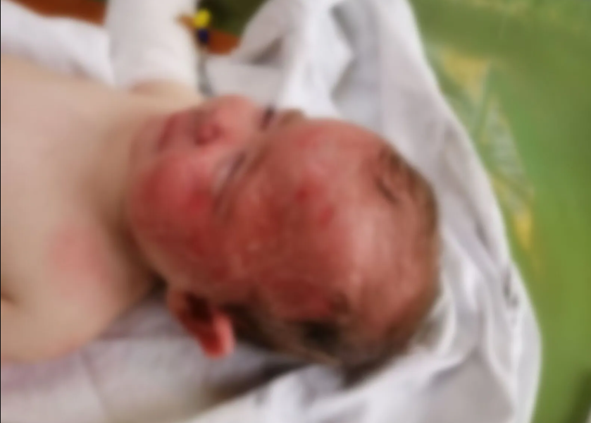 Загорелась подушка: в Запорожье 9-месячный ребенок получил серьезные ожоги (ФОТО)